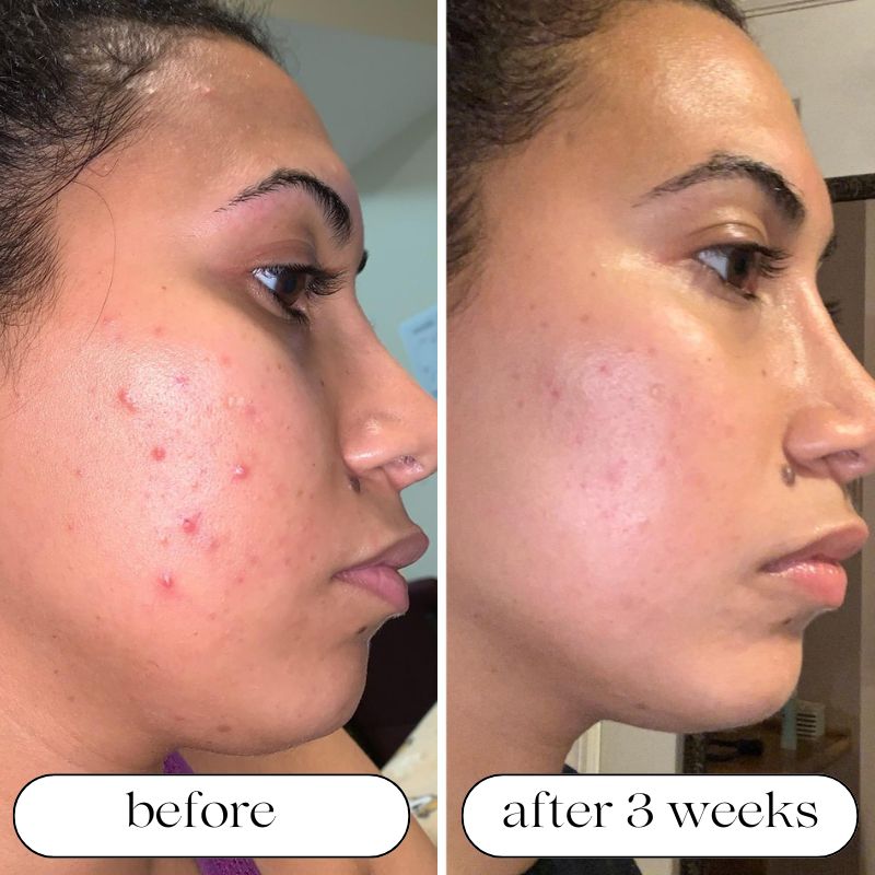 Seven-Wavelength LED Skin Care Device With Light Therapy