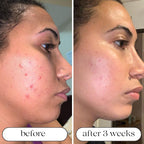Seven-Wavelength LED Skin Care Device With Light Therapy