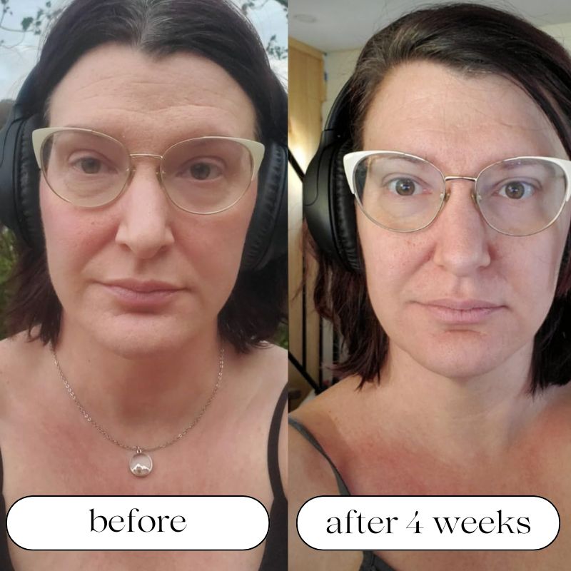 Seven-Wavelength LED Skin Care Device With Light Therapy