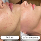 Seven-Wavelength LED Skin Care Device With Light Therapy