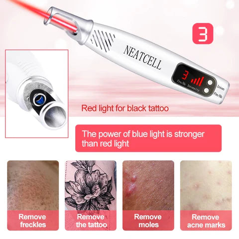 LumiDerm Laser Pen for Tattoo, Moles & Freckles Removal