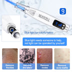 LumiDerm Laser Pen for Tattoo, Moles & Freckles Removal