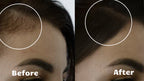Zařízení Light Wave s červeným světlem pro růst vlasů pomáhá při řídnutí vlasů