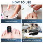 ApexNova Toenail Fungus Laser Therapy Device for Home Use
