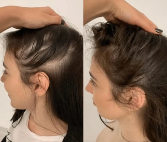 لومورا فرشاة استعادة الشعر الطبيعية 3 في 1 | مدلك فروة الرأس