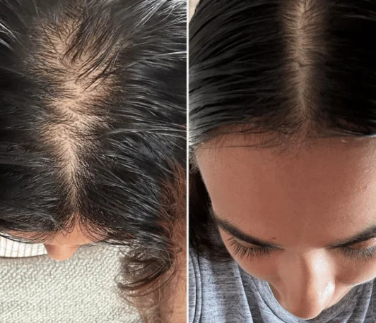 لومورا فرشاة استعادة الشعر الطبيعية 3 في 1 | مدلك فروة الرأس