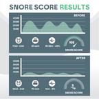 Protector Bucal Antironquidos SomniGuard con Ajuste Personalizado