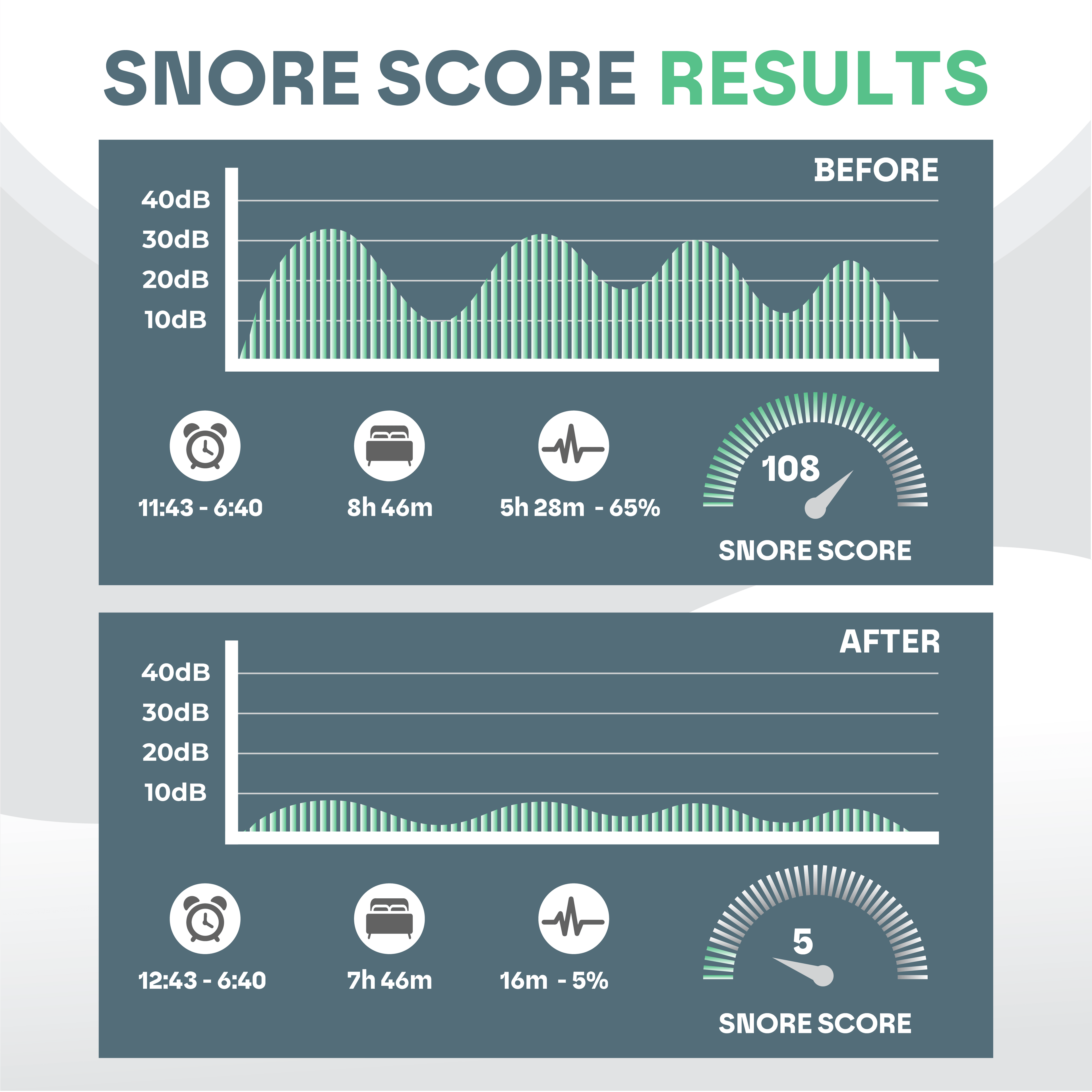 Protector Bucal Antironquidos SomniGuard con Ajuste Personalizado