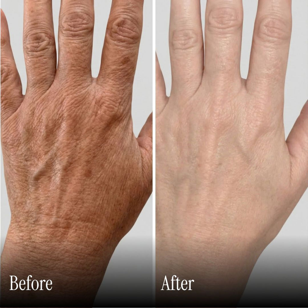Wireless Gloves With Red Light Heating For Hands And Wrists