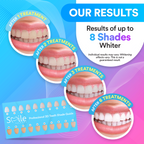 LumiWhite PAP+ LED Tandblegningssystem