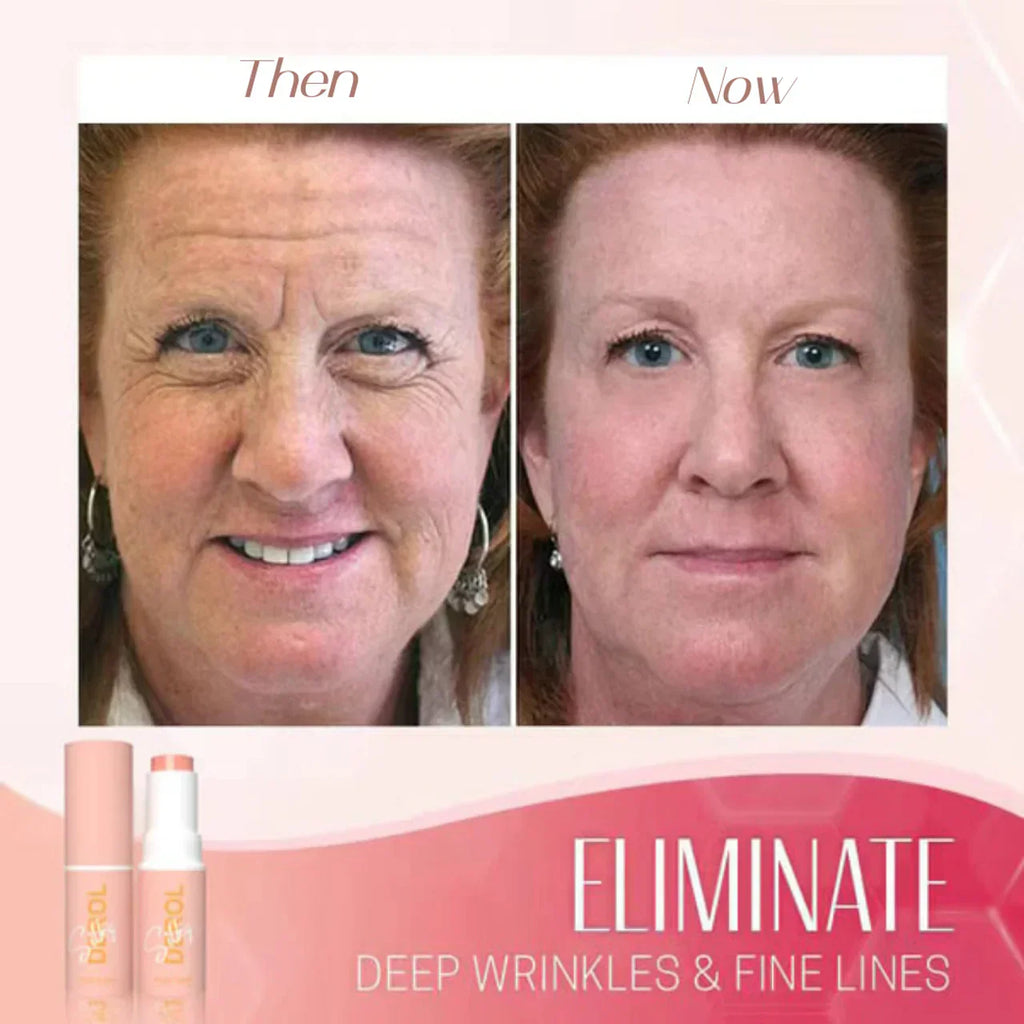 LumaSpring ruganyos balzsam