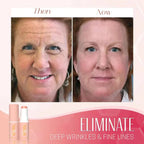 LumaSpring ruganyos balzsam