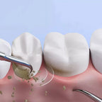 OralPro ultradźwiękowe urządzenie do usuwania kamienia nazębnego do użytku domowego