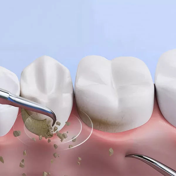 OralPro ultradźwiękowe urządzenie do usuwania kamienia nazębnego do użytku domowego
