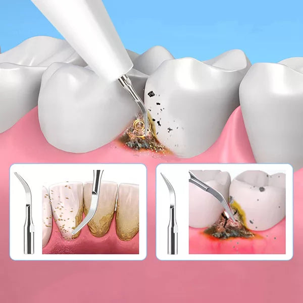 OralPro ultradźwiękowe urządzenie do usuwania kamienia nazębnego do użytku domowego