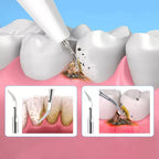 OralPro ultradźwiękowe urządzenie do usuwania kamienia nazębnego do użytku domowego