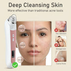 LuminaPore HD Pore Extractor | See & Remove Blackheads in Real Time