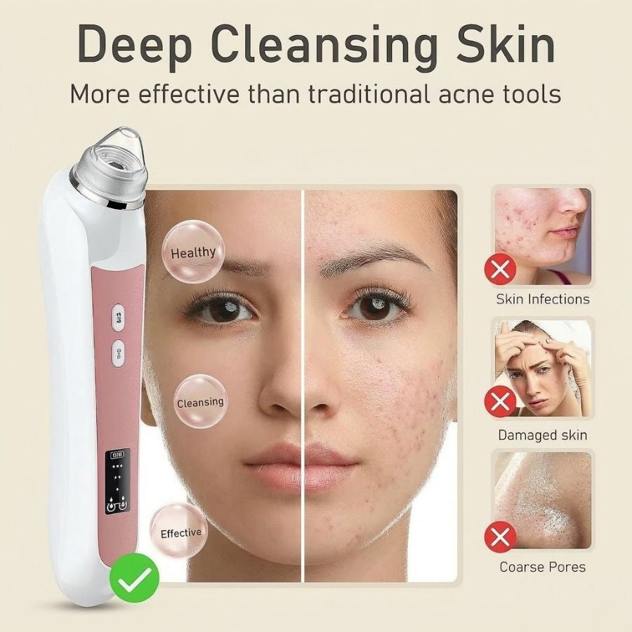 LuminaPore HD Pore Extractor | See & Remove Blackheads in Real Time