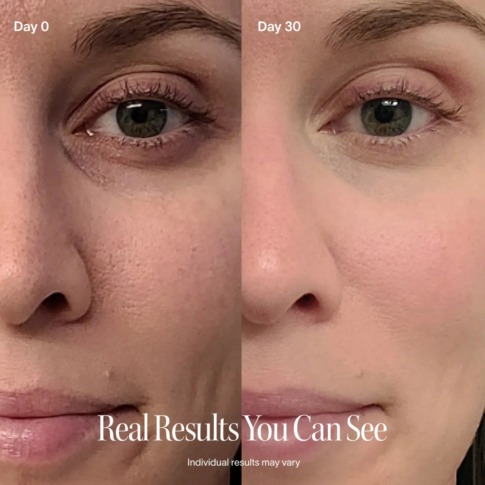 Multifunctionele beautywand voor een stralende huid, fijne lijntjes en een egale teint