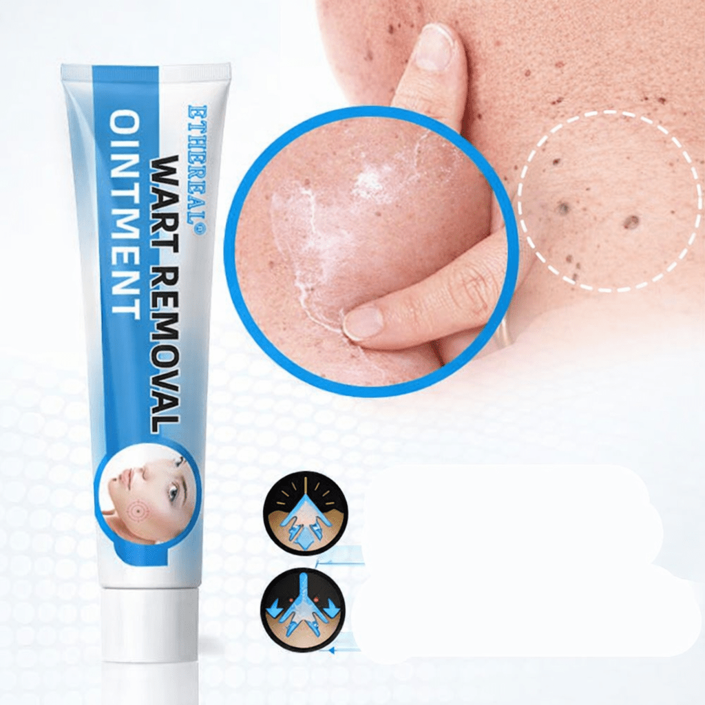 Gentle Remover Cream For Unwanted Skin Growths On Hands And Feet