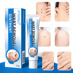 Gentle Remover Cream For Unwanted Skin Growths On Hands And Feet