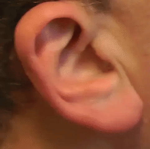 NovaSound Usynlige Høreapparater Duo til Mild til Alvorlig Høretab