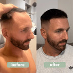 Revitalizador Capilar Pro-Crecimiento en Roll-On para Cabello Fino