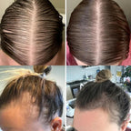 Aceite nutritivo para el cuero cabelludo AureaGrow para ayudar al cabello fino