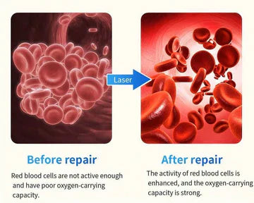 DiaSense Pro Smartwatch per il Controllo del Glucosio nel Sangue per la Gestione del Diabete a Casa