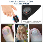 ApexNova Toenail Fungus Laser Therapy Device for Home Use