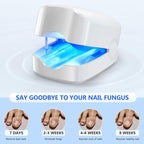 NexaLume At Home Laser Toenail Fungus Treatment Device