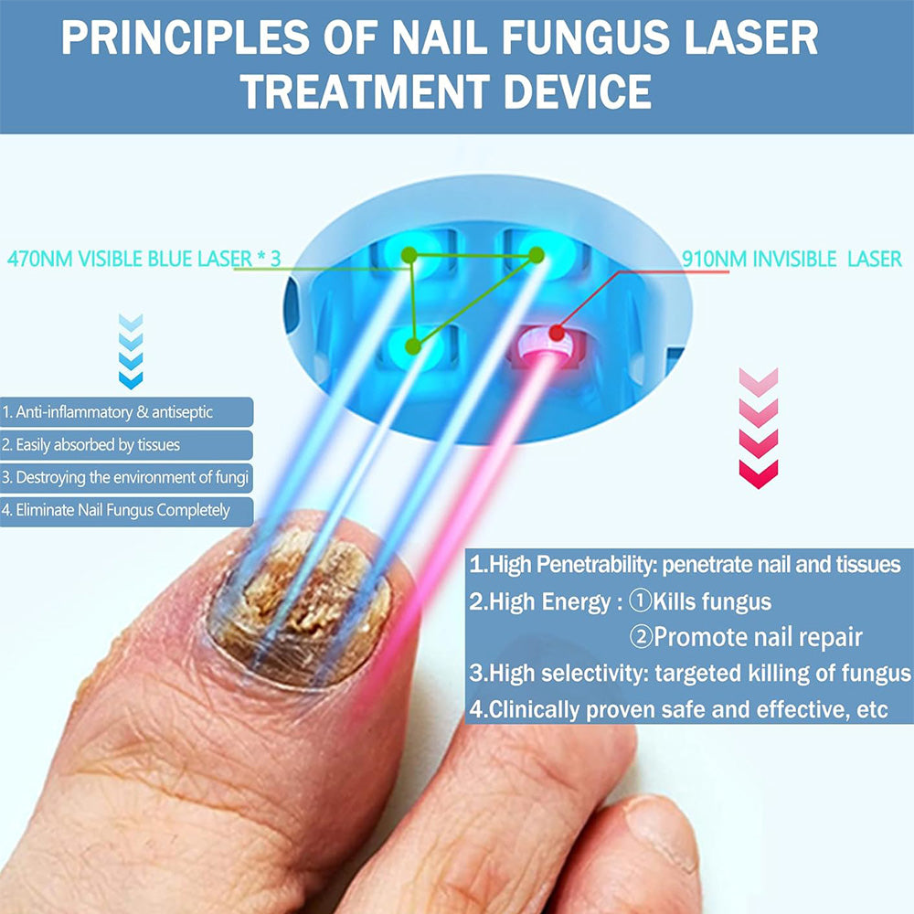 Professional-Grade Home Nail Laser Device For Toenails