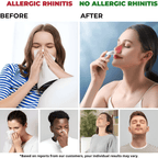 علاج الأنف بالضوء الأحمر NoseNova لتخفيف الجيوب الأنفية والاحتقان