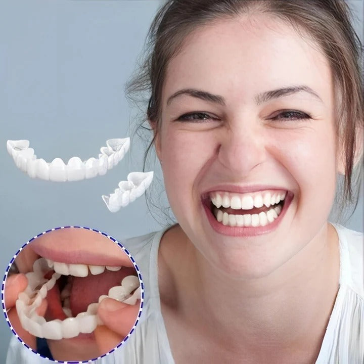 Removable Smile Veneers for Upper and Lower Teeth