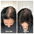 LuminaScalp 3-in-1 Hair Growth System | 10-Minute At-Home Scalp Treatment for Thicker Hair
