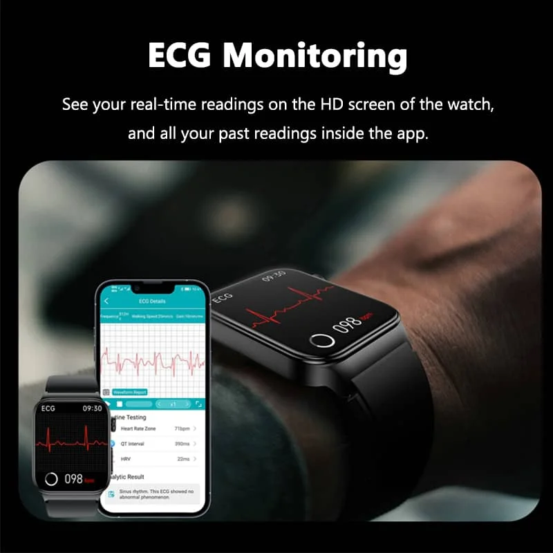 NovaPulse All-in-One Watch With ECG And Glucose Tracking