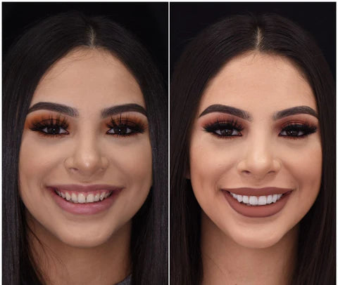 Fațete Instantanee LumaGrin cu Fixare Rapidă pentru Dinții Superiori și Inferiori