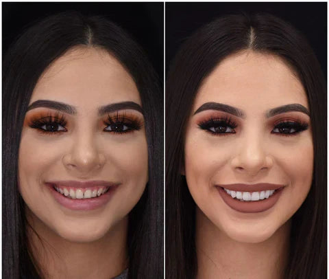 قشور نوفابرايت القابلة للتركيب للأسنان العلوية والسفلية ابتسامة طبيعية فورية