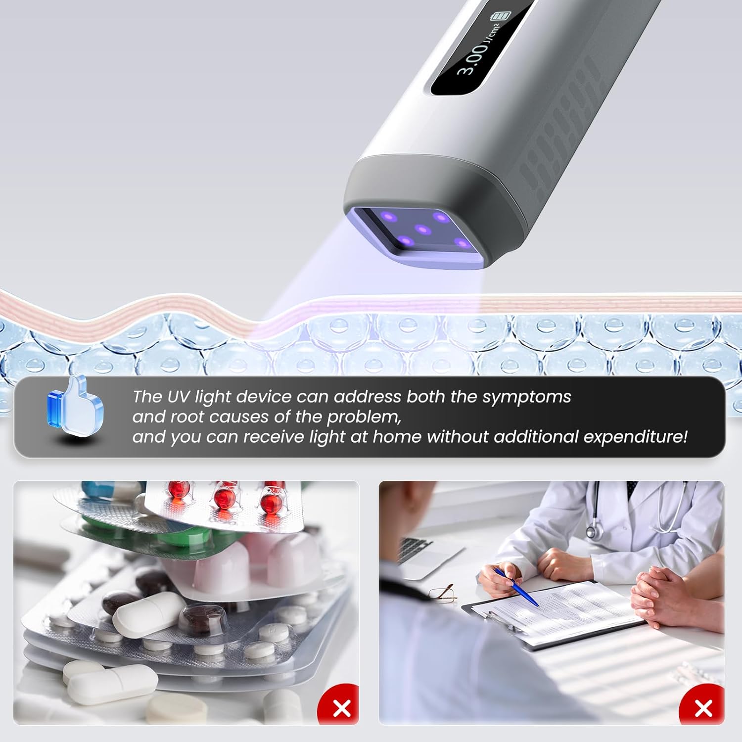 Dispositivo Portatile di Fototerapia UVB 308nm 2026 – Trattamento Domestico per Psoriasi, Eczema, Vitiligine e Altro