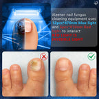 Multi-Nail Wellness Light Device – Blue & Infrared Light for Clearer, Healthier-Looking Nails