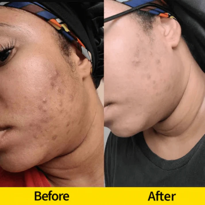 Brightening Turmeric & Kojic Acid Cleansing Bar for Face and Body