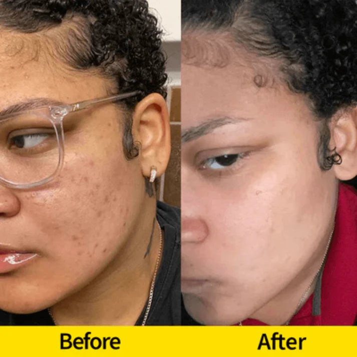 Brightening Turmeric & Kojic Acid Cleansing Bar for Face and Body