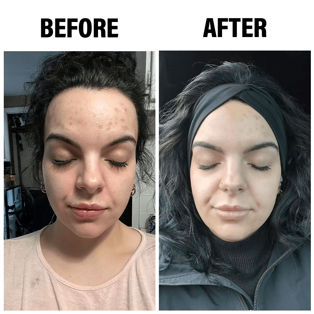 Brightening Turmeric & Kojic Acid Cleansing Bar for Face and Body