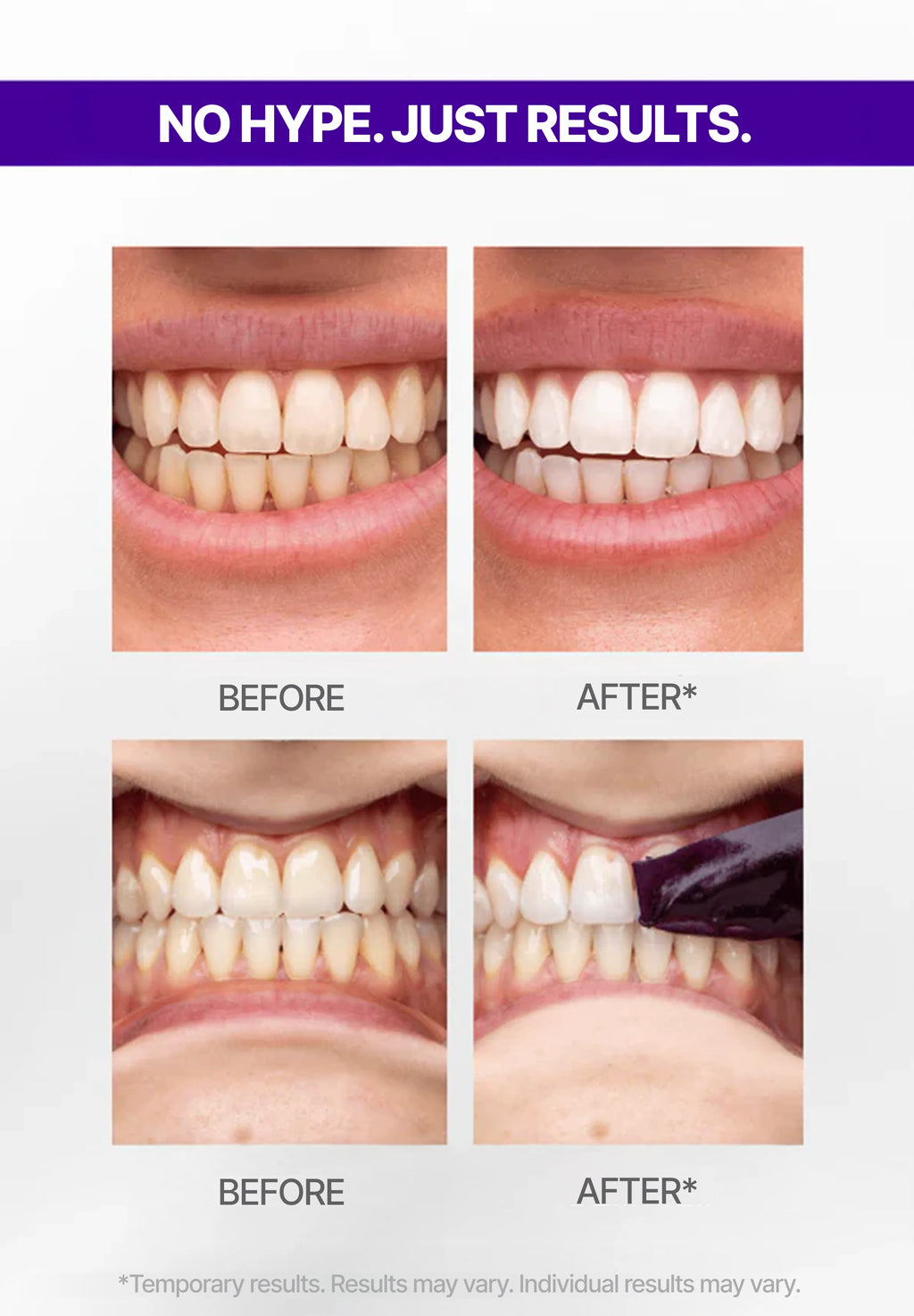 V34 Teeth Whitening Strips