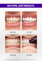 V34 Teeth Whitening Strips