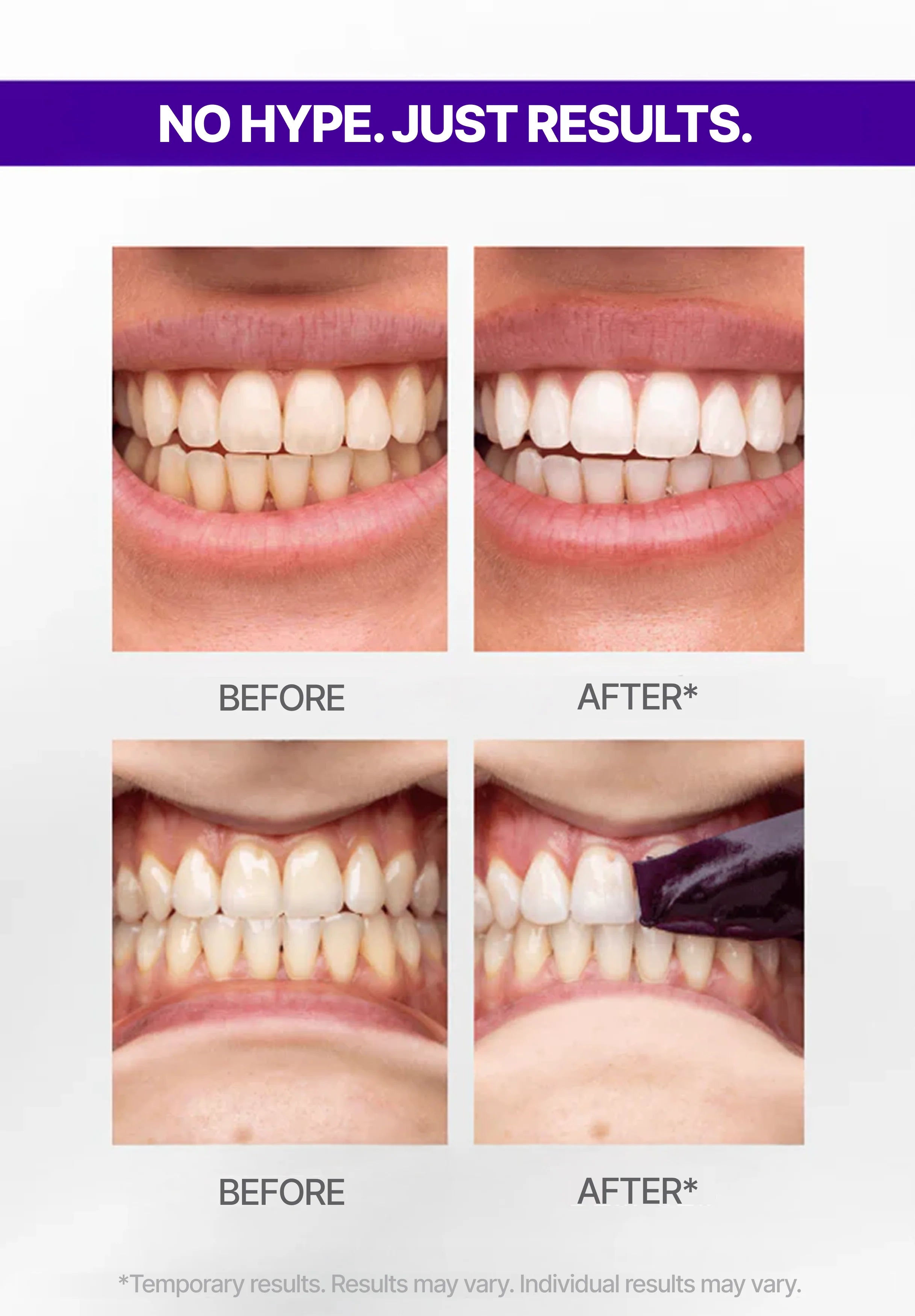 V34 Teeth Whitening Strips
