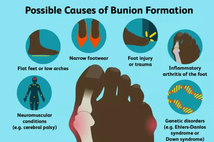 CalmStep | Justerbar knystkorrigerende til smertelindring