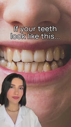 LumiWhite PAP+ LED Tandblegningssystem