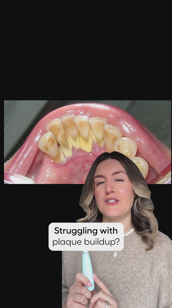 Ultralyds Tandrenser – Avanceret Smilteknologi