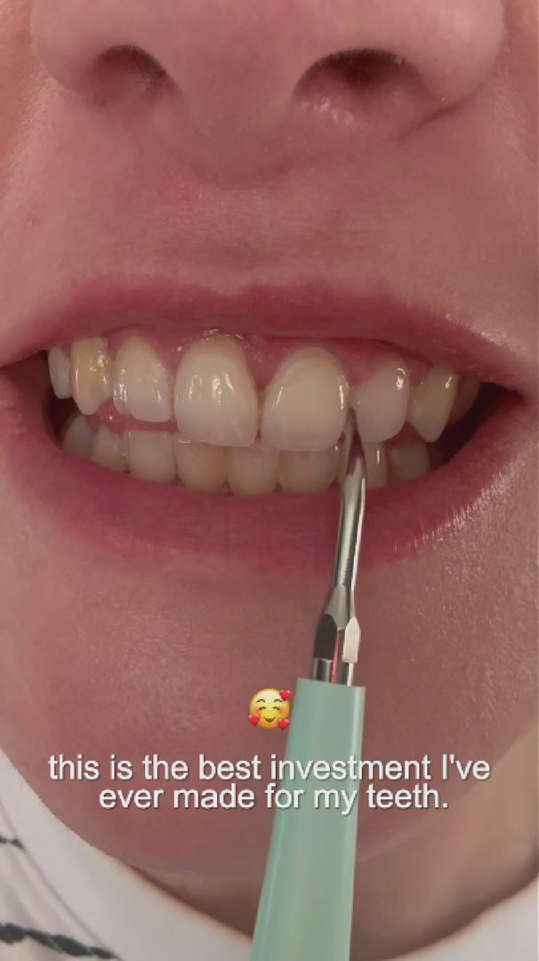 Ultralyds Tandrenser – Avanceret Smilteknologi